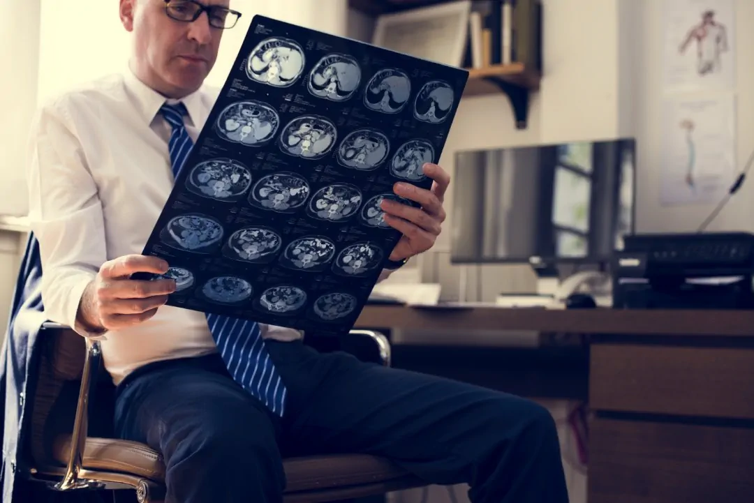 brain ct scan x ray film kidney stones